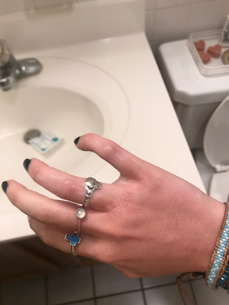 A picture of my hand covered in suds and spermicide from sponge insertion
